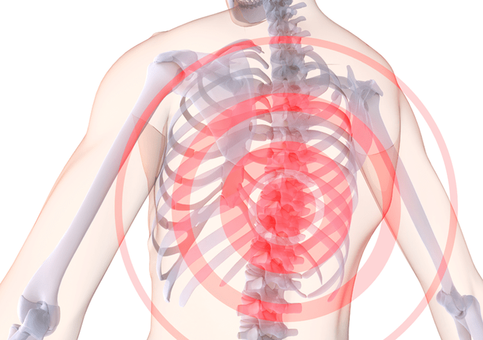 الداء العظمي الغضروفي في العمود الفقري الصدري